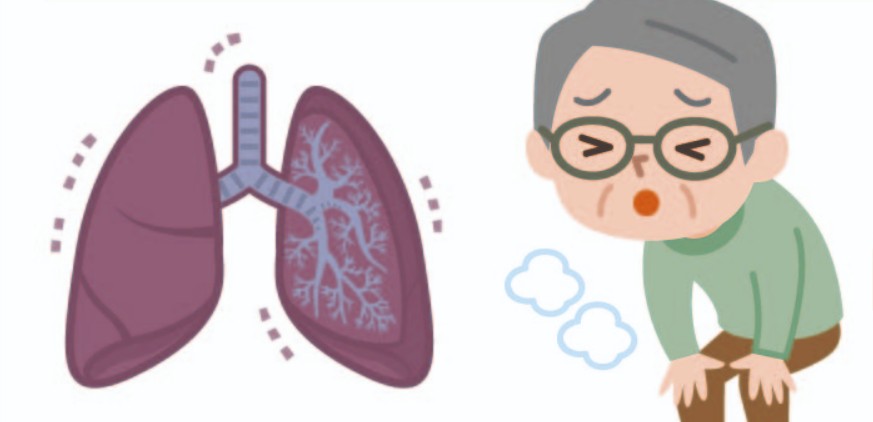 心肺負擔程度不同
