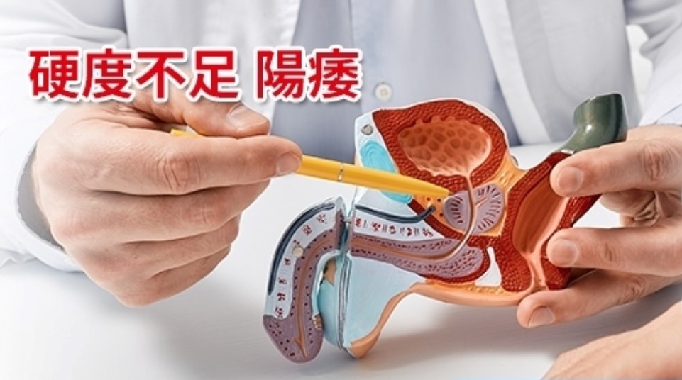 改善勃起功能障礙（ED）