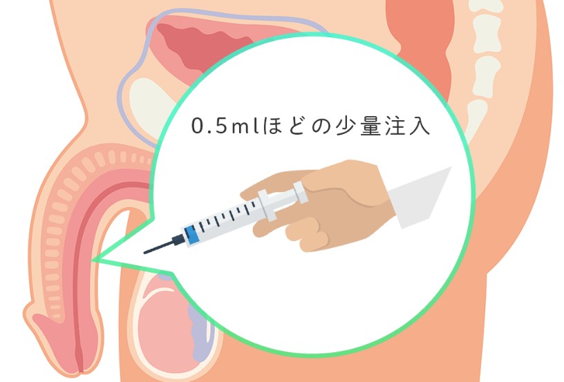 海綿體注射治療