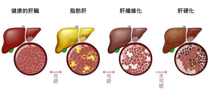 嚴重肝腎功能障礙者 嚴重肝腎功能障礙者