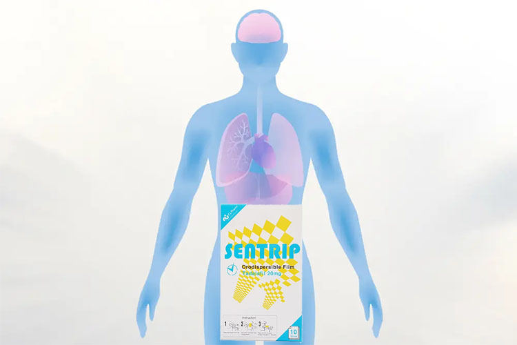 Sentrip口溶膜的作用機制:如何影響身體健康? Sentrip口溶膜的作用機制:如何影響身體健康?
